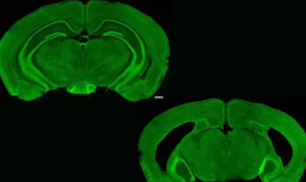 癫痫小鼠大脑中的星形胶质细胞表现出酸性反应癫痫发作加剧