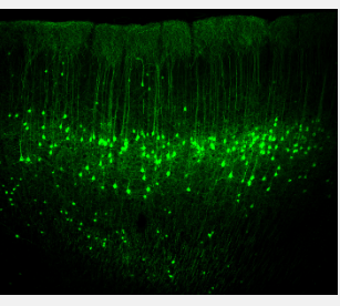 感觉运动皮层神经元活动的新发现