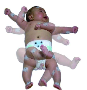 自发的婴儿运动对于协调感觉运动系统的发展很重要