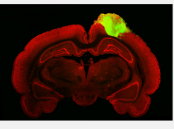 移植到成年大鼠体内的人脑类器官对视觉刺激有反应