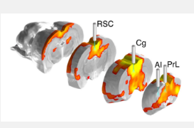 新型光学和fMRI平台可识别控制大规模大脑网络的大脑区域