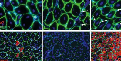 为了逆转干细胞的衰老NANOG基因重新连接代谢网络