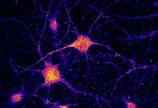 缺失环节解释了脑细胞中mRNA的传递