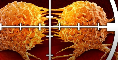 全外显子组测序预测癌症免疫治疗的反应