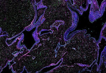 脑血管图谱识别新细胞类型并将免疫细胞与出血性中风联系起来