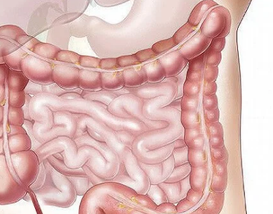 生活在胃肠道中的微生物可能预示着阿尔茨海默氏症和帕金森氏症等衰弱性疾病的诊断