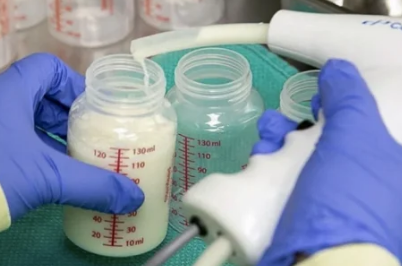 研究人员利用人工智能优化捐赠母乳的营养一致性