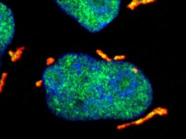 DHX9应激颗粒如何保护子细胞免受紫外线诱导的RNA损伤