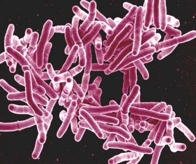 新的酶鸡尾酒可以杀死引起结核病的分枝杆菌